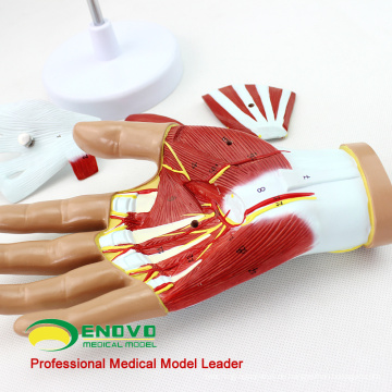 MUSCLE08 (12031) Menschliche Hand Anatomie Muskel 4-Teile Medical Education Model 12031